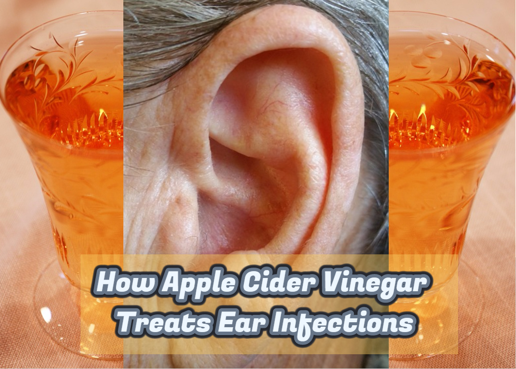 How Apple Cider Vinegar Treats Ear Infections
