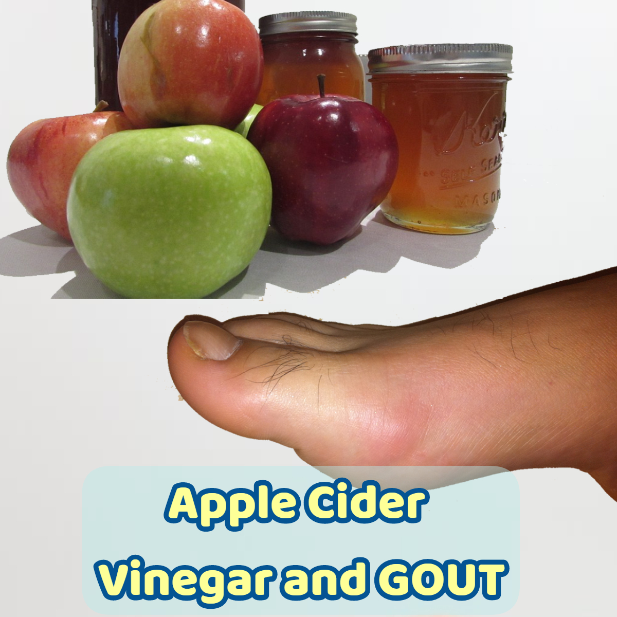 apple cider vinegar and gout